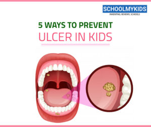 5 Ways To Prevent Ulcers In Children | SchoolMyKids